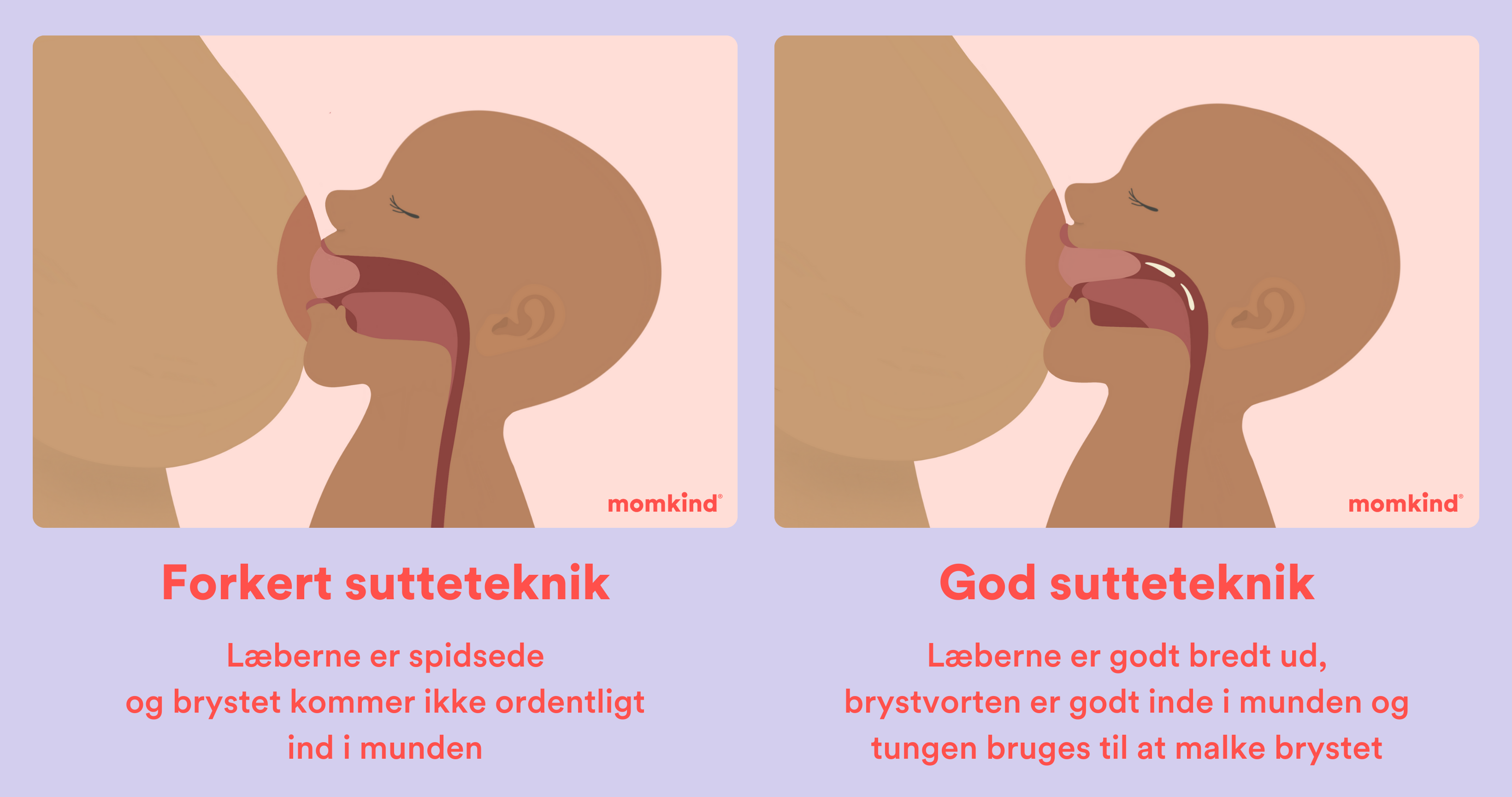 stramt tungebånd sutteteknik