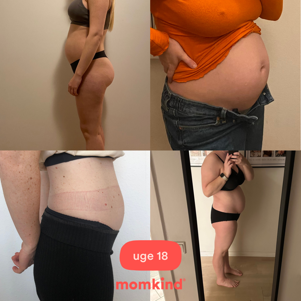 gravid uge 18 mavebilleder