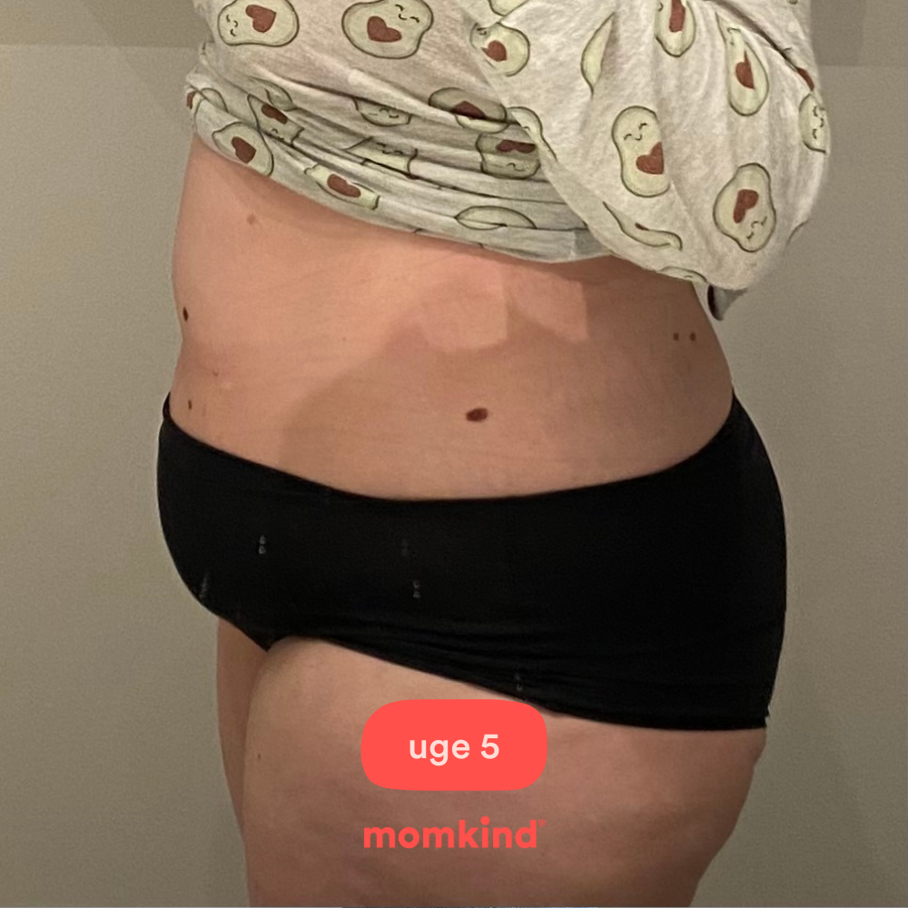 gravid uge 5 billeder