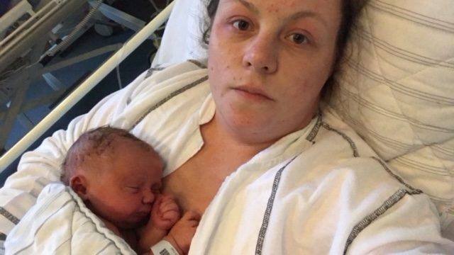 kejsersnit seng nyfødt