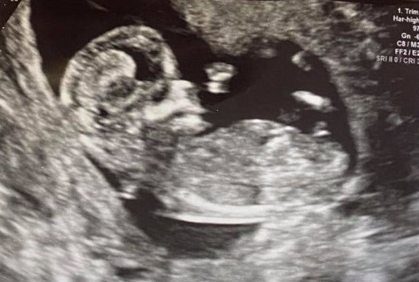 nub theory scanningsbillede dreng