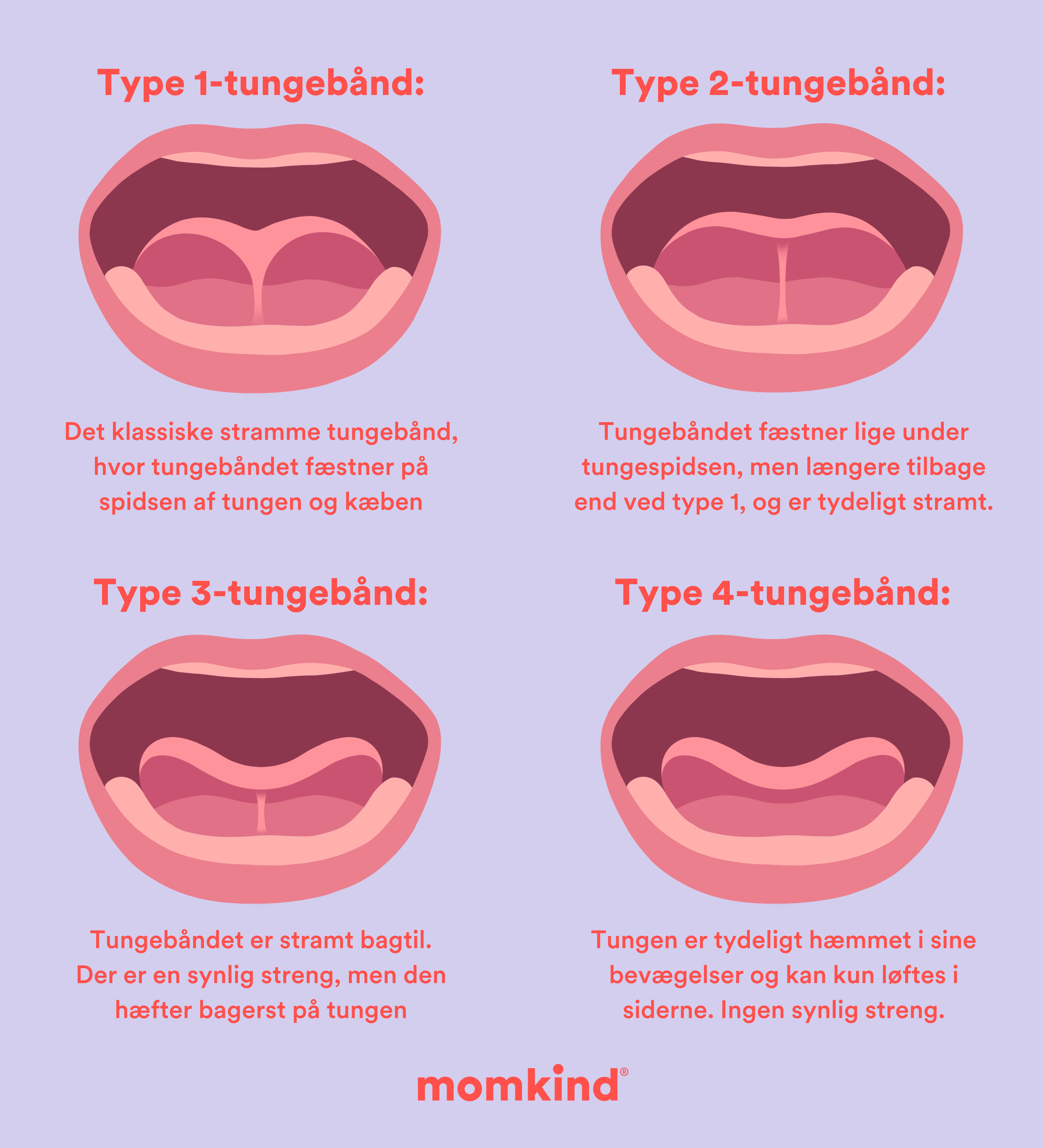 Typer af stramt tungebånd