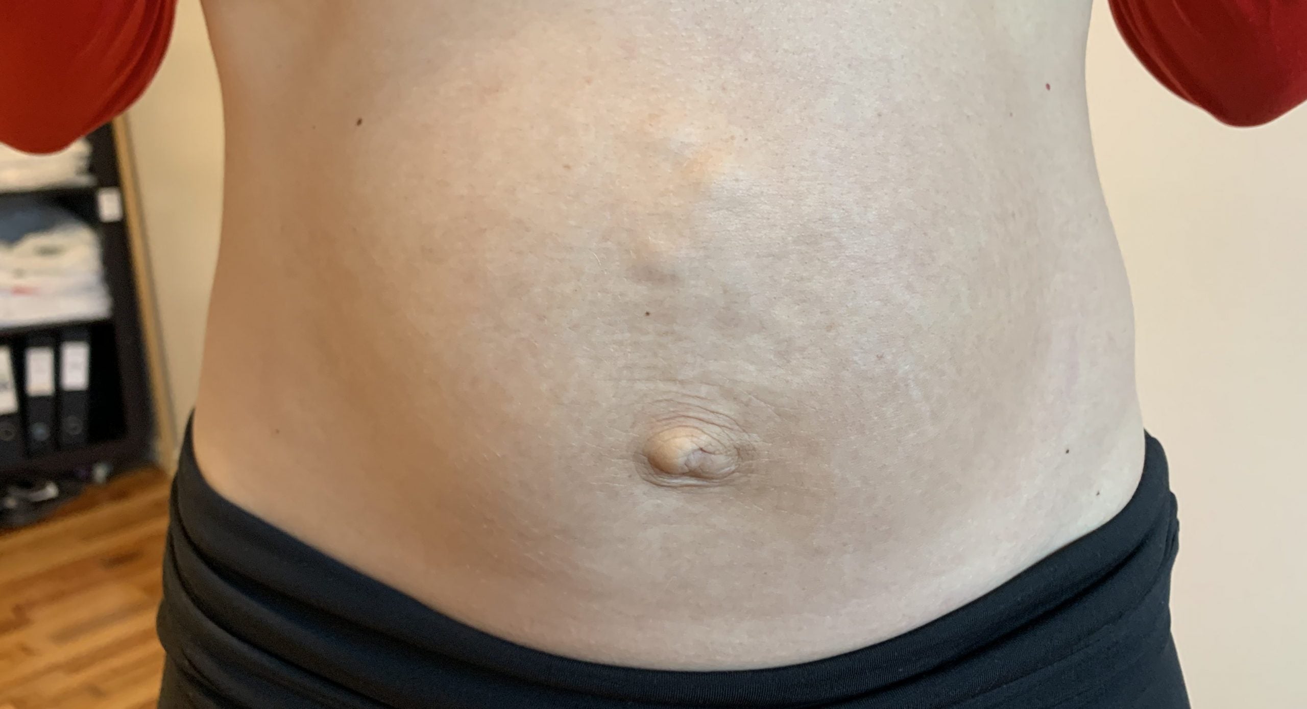 Rectus diastase – fysioterapeutens guide til delte mavemuskler efter fødslen