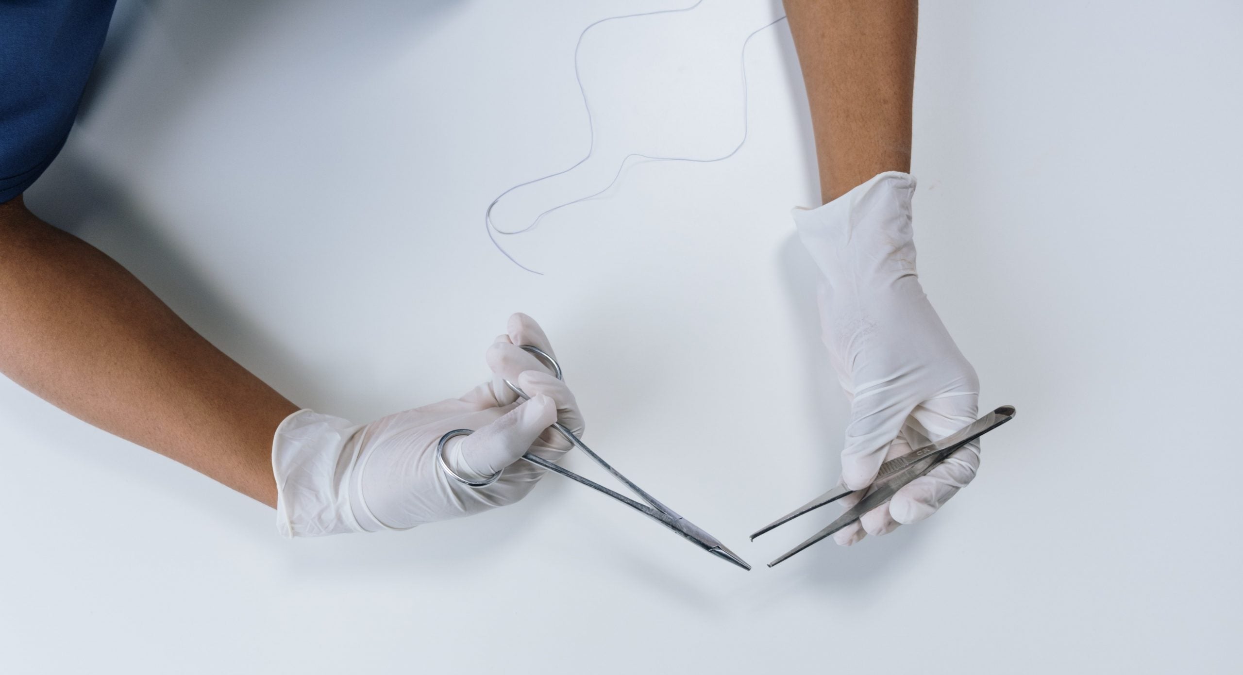 Syning efter fødsel: Her er alt du skal vide