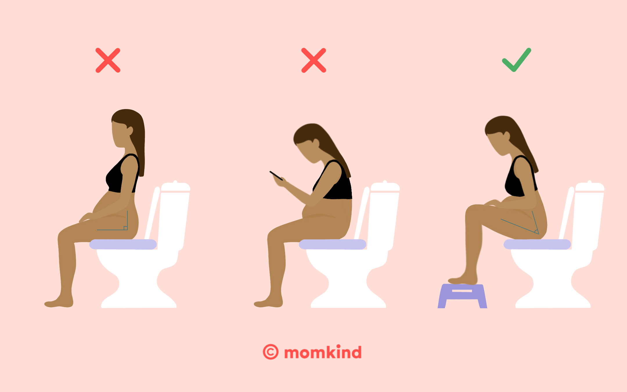 hæmorider og toilet positioner