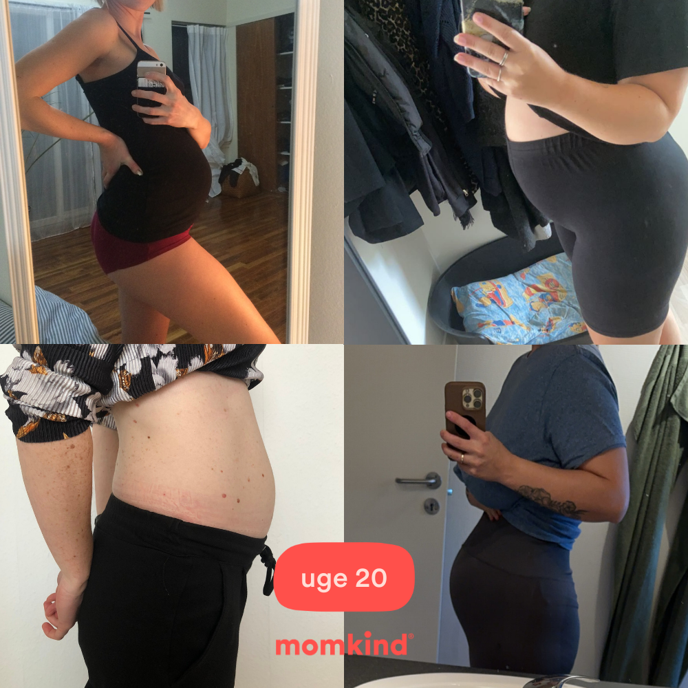 gravid uge 20 mavebilleder