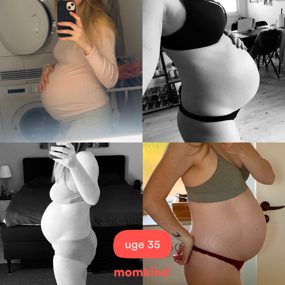 gravid uge 35 mavebilleder