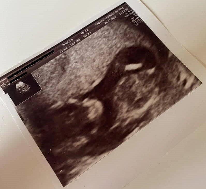 nub theory scanningsbillede pige